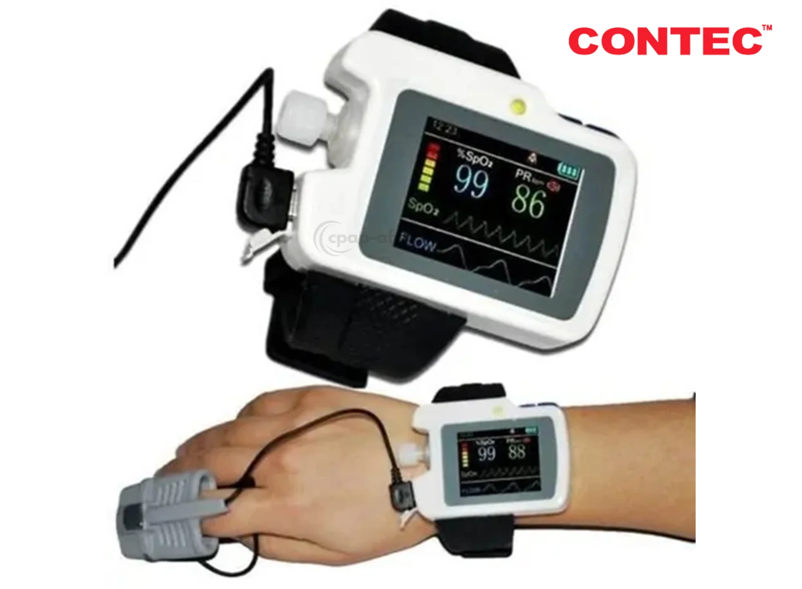 CONTEC RS01